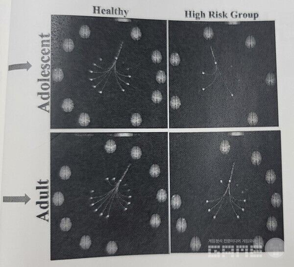 한 교수의 핵심 주장이 담긴 발표 자료, 성인으로 가면서 연결성이 늘어나지만 정상인에 비해 부족해 보인다. 사진=게임와이 촬영